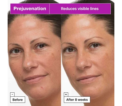 Prejuvenation Firming Bakuchiol Cream For Preventative Aging