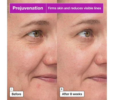 Prejuvenation Firming Bakuchiol Serum For Preventative Aging