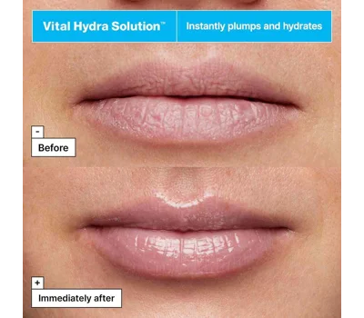 Vital Hydra Solution™ Jelly Bear Lip Mask With Hyaluronic Acid