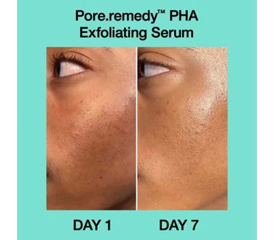 Pore Remedy™ Pha Exfoliating Serum 30ml