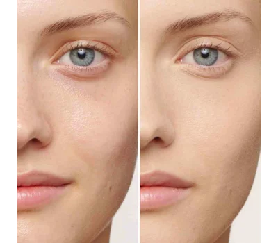 Skin Illusion Full Coverage