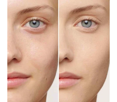 Skin Illusion Full Coverage