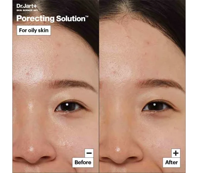 Dermask™ Porecting Solution Face Mask