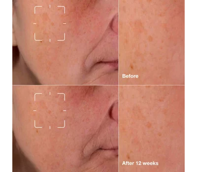 Even Better Clinical™ Dark Spot Clearing Serum 50ml