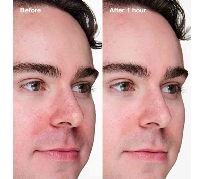 Anti-Blemish Solutions Clinical™ Advanced Clearing Gel 20ml