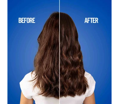 Uniq One Mental Hair Treat 150ml