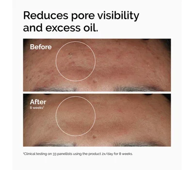 Niacinamide 10% + Zinc 1% 60ml