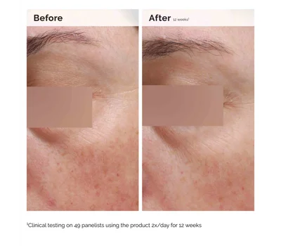 Niacinamide 5% Face & Body Emulsion 100ml