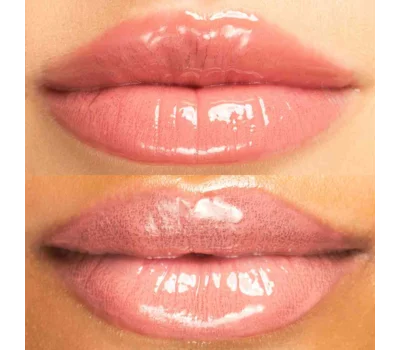 Hyaluronic Lip Restore Balm