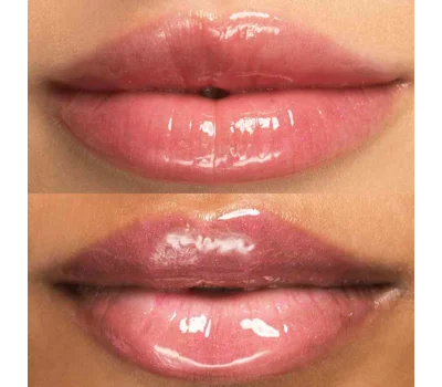 Hyaluronic Lip Restore Balm