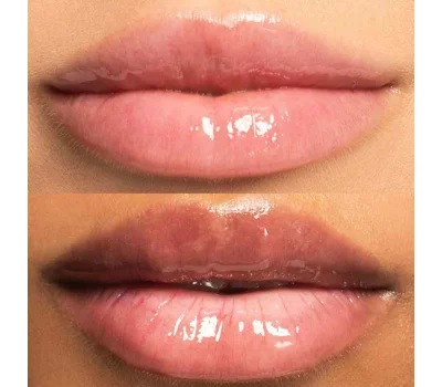 Transparent Hyaluronic Lip Oil