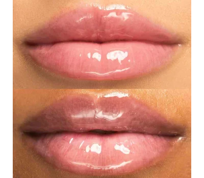 Hyaluronic Lip Oil Vitamin E & Castor Oil