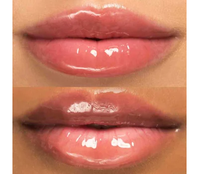 Hyaluronic Lip Oil Vitamin E & Castor Oil