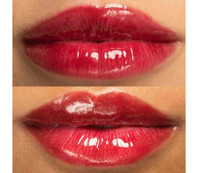 Hyaluronic Lip Oil Vitamin E & Castor Oil