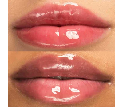 Hyaluronic Lip Oil Vitamin E & Castor Oil