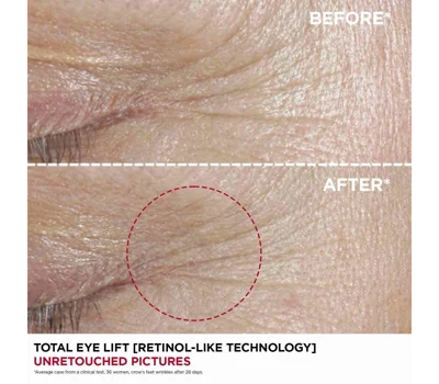 Total Eye Lift Retail 15ml