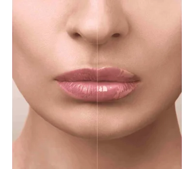 Absolue The Lip Balm 12G