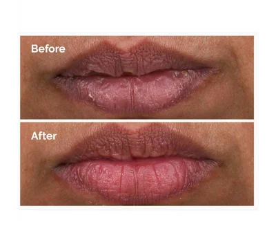 Pha 5% Exfoliating Lip Serum 15ml