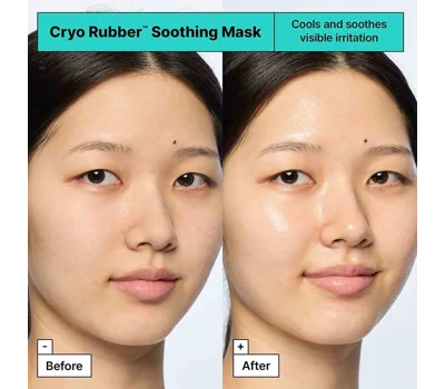 Cryo Rubber™ Soothing Face Mask With Allantoin