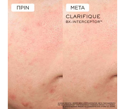 Clarifique Bx-Interceptor™ Serum 30 ml