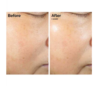 Rice Lipids + Ectoin Microemulsion 60ml