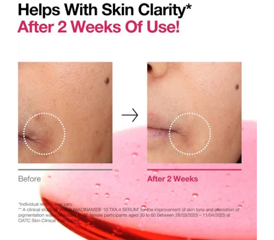 Niacinamide 10% + TXA 4% Serum