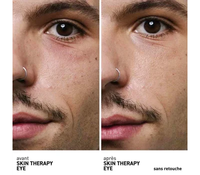 Skin Therapy Eye 15ml
