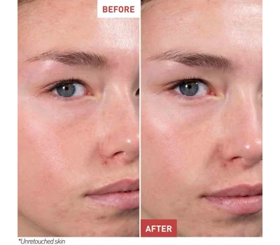 Skin Hero - Bare Skin Perfector