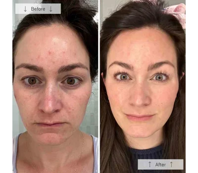 Contour Face