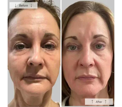 Contour Face