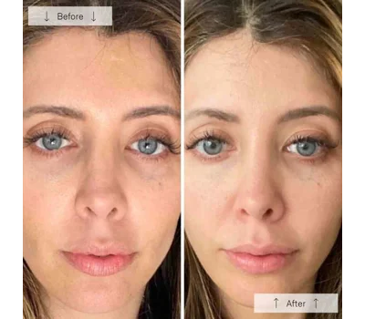Contour Face