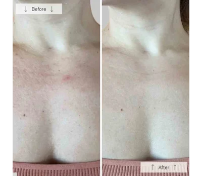 Contour Neck & DéColleté