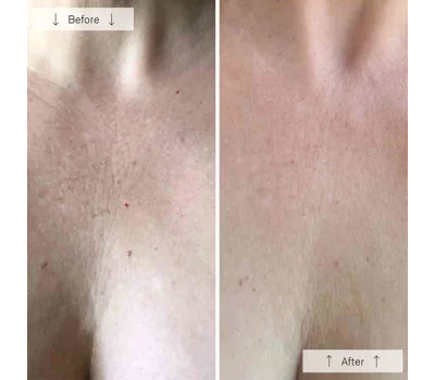 Contour Neck & DéColleté