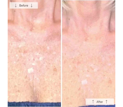Contour Neck & DéColleté