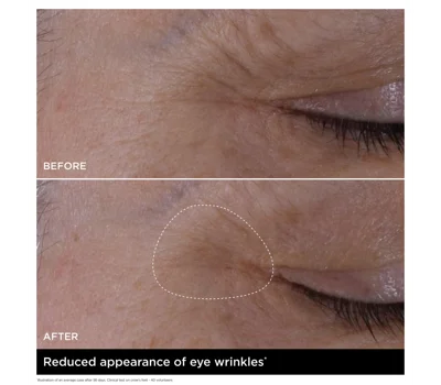 Double Serum Eye 20ml