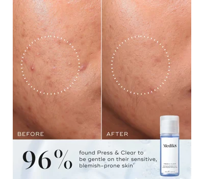 Press & Clear 150ml