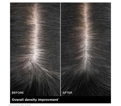 Fortifying Scalp Serum