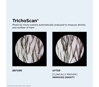 Fortifying Scalp Serum