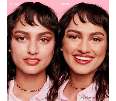 Boi-Ing Cakeless Concealer