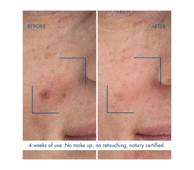 Blue Retinol Night Serum 30ml