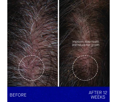 The Scalp Treatment 30ml