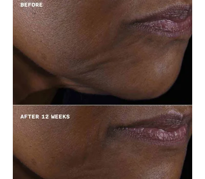 Clinique Smart Clinical Repair™ Lifting Face + Neck Cream 50ml