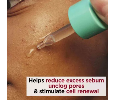 My Clarins Pure-Reset Resurfacing Blemish Serum 30ml