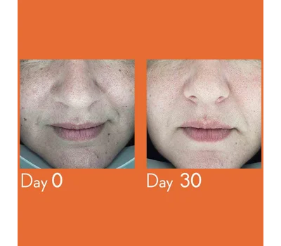 Dark Spot Remover Serum 30ml
