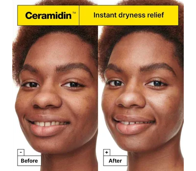 Ceramidin™ Skin Barrier Moisturising Cream