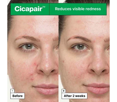 Cicapair™ So Soothing Treatment For Visibly Irritated Skin