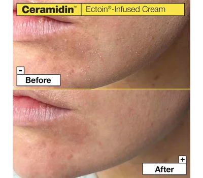Ceramidin™ Ectoin®-Infused Cream