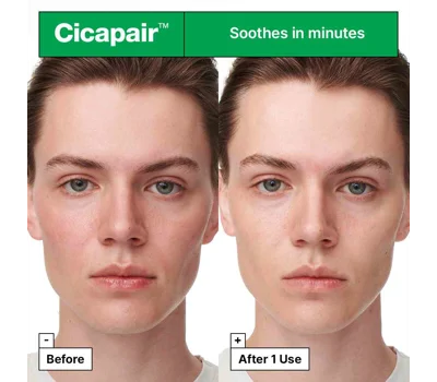 Cicapair™ Sensitive Skin Serum Face Mask For Redness