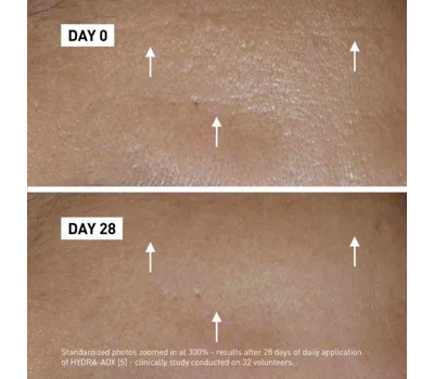 Hydra-Aox [5] Serum - Intensive Antioxidant Serum 30ml