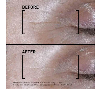 Time-Filler Shot 5Xp - Concentrated Serum 15ml